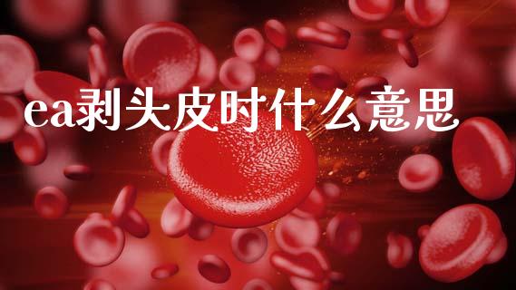 ea剥头皮时什么意思_https://m.lcpcjs.com_白银期货保证金_第1张